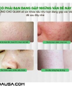 Bột Ngũ Hoa thuốc Bắc đắp mặt nguyên chất giúp giảm mụn